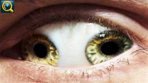 10 Weirdest And The Most Terrifying Eyes Youtube
