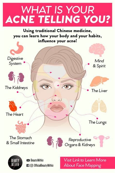 What Is Your Acne Telling You Skin Care Acne Acne Skin Beauty Skin