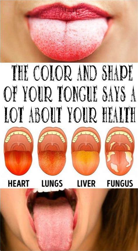 What Your Tongue Says About Your Health Tongue Health How To Stay