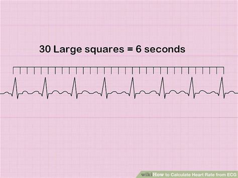 How To Calculate Heart Rate From Ecg 8 Steps With Pictures Wiki