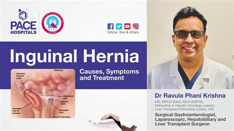 Inguinal Hernia Groin Hernia Causes Symptoms And Treatment Dr