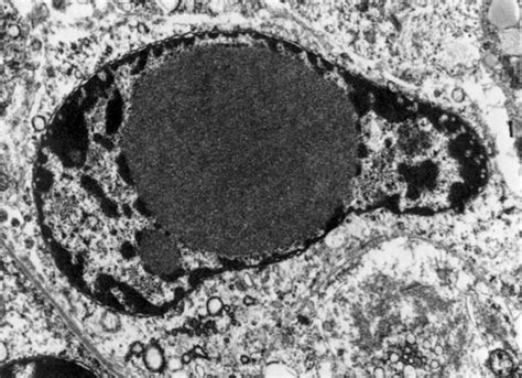 Biol Lecture Guide Electron Micrograph Of A Nucleus