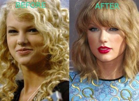 Taylor Swift Nose Job And Possible Blepharoplasty Botoxresults