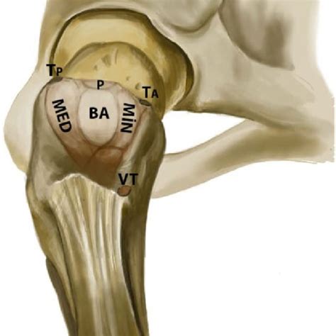 Pdf Bare Area On The Trochanter And Its Correlations To Gluteal