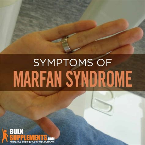 Marfan Syndrome Causes Symptoms And Treatment By James Denlinger