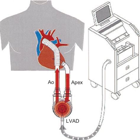 Pdf Novel Biomarkers In Human Terminal Heart Failure And Under