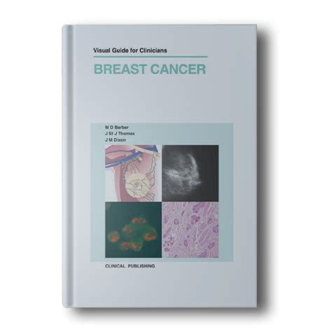 Breast Cancer Visual Guide For Clinicians Books And Book