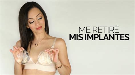 Decidi Extraer Mis Implantes A Menos De Un A O De Haberme Operado Breast Implant Illness Youtube