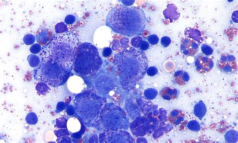 Image Gallery Lymph Node Cytology Clinicians Brief