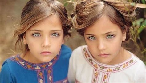 Irmãs Consideradas “as Gêmeas Mais Lindas Do Mundo” Cresceram E Hoje