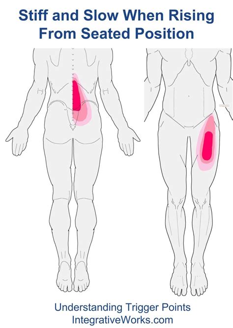 Stiff And Slow When Rising From Seated Position Integrative Works Trigger Points Trigger