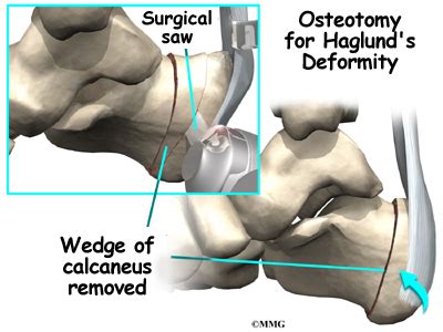 Patient Education Concord Orthopaedics