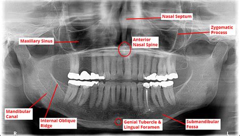 Radiology X Ray Positions Dentmistry