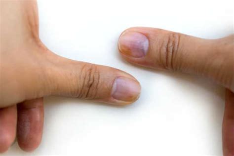 8 Warning Signs From Your Fingernails About Your Health Healthy