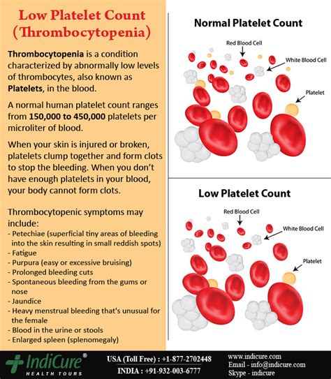 Enlarged Red Blood Cells And Low Platelets Newteam 2022