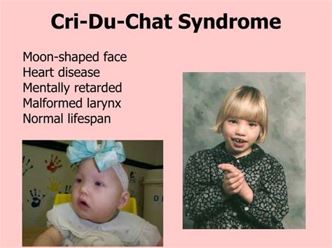To assess the severity of this syndrome, also. PPT - Chromosomal Mutations & their effects PowerPoint ...