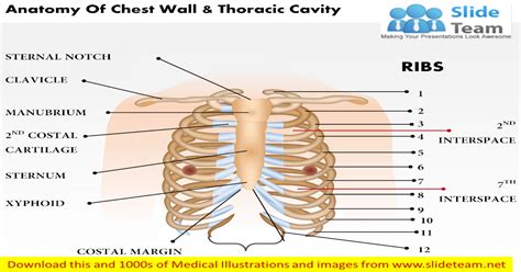 Pathology of the heart, mediastinum, lungs and the second most common chest wall abnormalities that we see on a cxr are metastases in vertebral bodies and ribs. Anatomy of chest wall and thoracic cavity medical images for power point - PDF Document