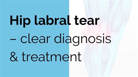 Hip Labral Tear Clear Diagnosis And Treatment Sports Injury Online