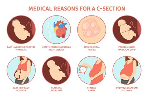 Signs That You May Have A C Section Infection