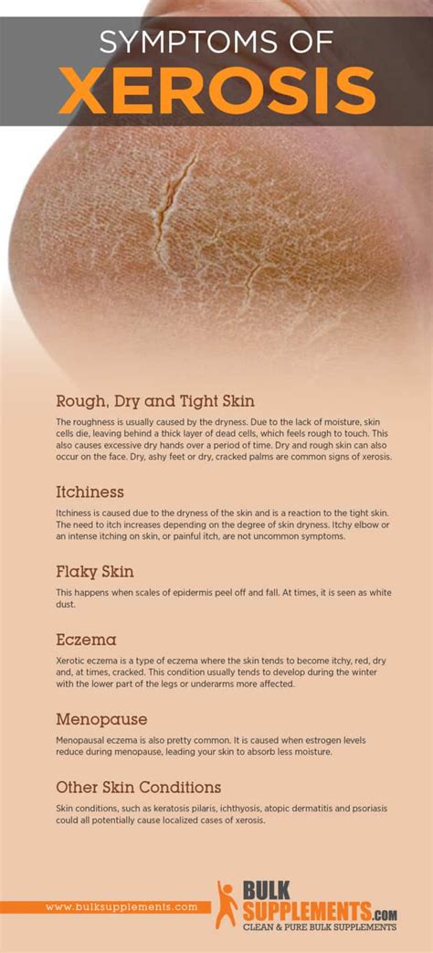 Xerosis Dry Skin Symptoms Causes And Treatment