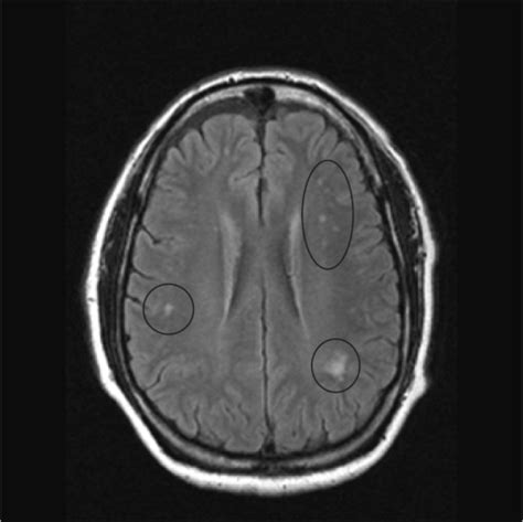 Mri Image Of The Brain In An Axial View Showing The “ Open I