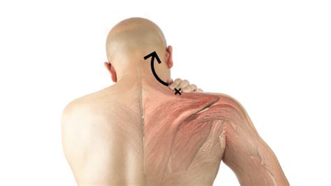 Is Your Headache Really A Shoulder Problem