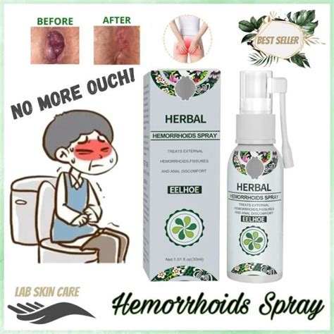 100 effective eelhoe yunnan natural herbal hemorrhoids spray original gamot sa almoranas