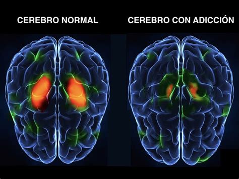 ¿qué Pasa En El Cerebro De Una Persona Adicta A Sustancias Psicodex