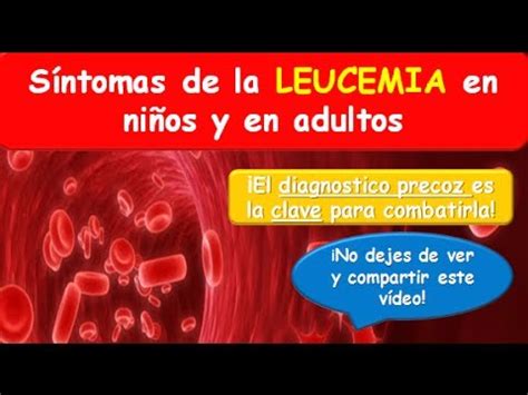 Os sintomas da leucemia (tipo de câncer no sangue) começam a aparecer quando o numero de células cancerígenas (anormais) no sangue aumenta e a medula óssea não pode fabricar as células. LEUCEMIA: Síntomas de la Leucemia en niños y en adulto ...