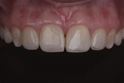 Composite Dental Implant Speciality Centre