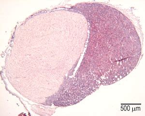 Glandular Tissue The Histology Guide Vrogue Co