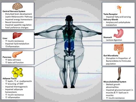 Pathophysiology Obesity Medizzy