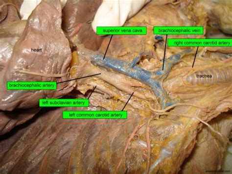 Cat dissectionsuperior arteries and veinsstudent guide. Major Arteries and Veins of the Cat | Anatomy Corner