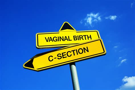 Vaginal Birth After C Section And Hie Hie Resource Place