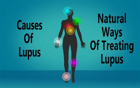 Causes of Lupus understanding the Lupus and natural ways of treating it
