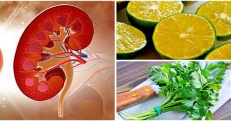 We applaud sanna's bravery and her ability to keep seeking nutritional excellence, even after being told that it was impossible to reverse stage 3 kidney disease. Physicians' Favorite Natural Lemon Recipe For Removing Kidney Stones | Savvy Life Mag