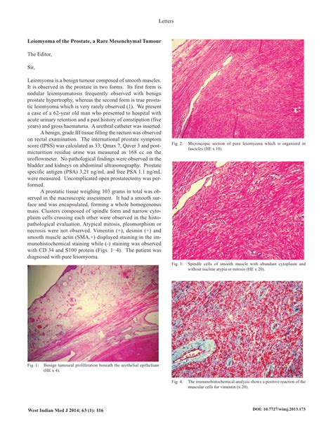 Pdf Leiomyoma Of The Prostate A Rare Mesenchymal Tumour