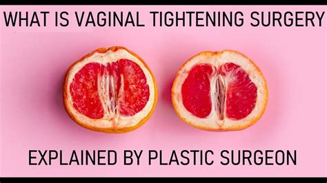 What Is Vaginal Tightening Surgery Explained By Plastic Surgeon Youtube