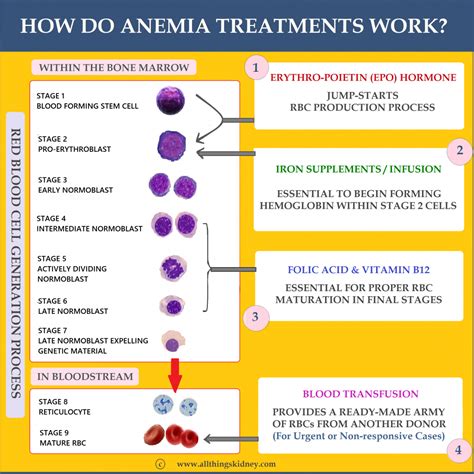 Anemia In Ckd Treatment All Things Kidney ~ Official