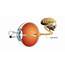 Optic Nerve Damage Accompanying Eye Diseases & Conditions  IrisVision