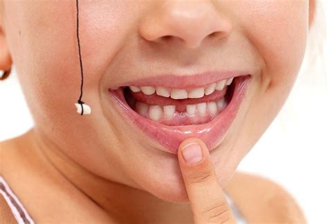 Here are some easy ways to pull out a loose tooth without any pain. Pull the tooth out painlessly