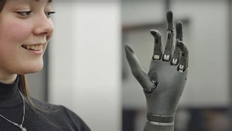 This Bionic Hand Actually Improves Function Over Time Nerdist
