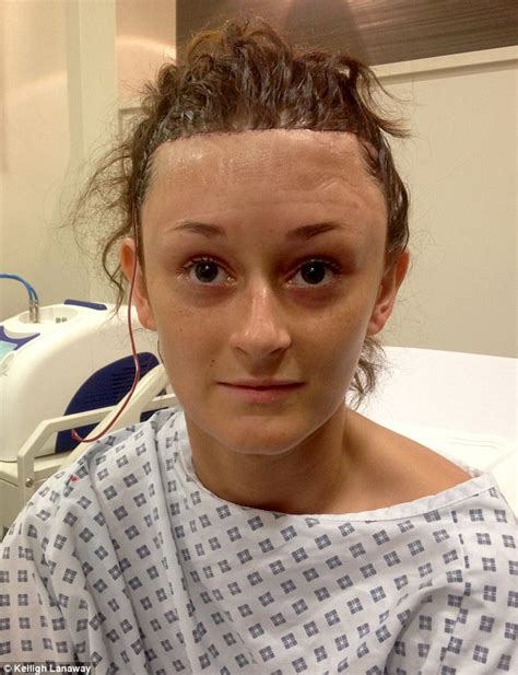 Kent Woman Bullied For Large Forehead Got £6500 Surgery Daily Mail Online