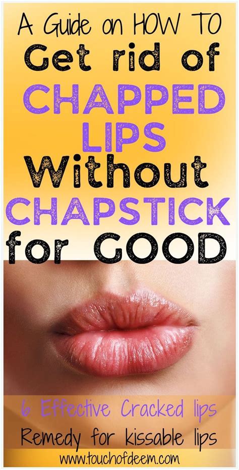 How To Get Rid Of Chapped Lips Artofit