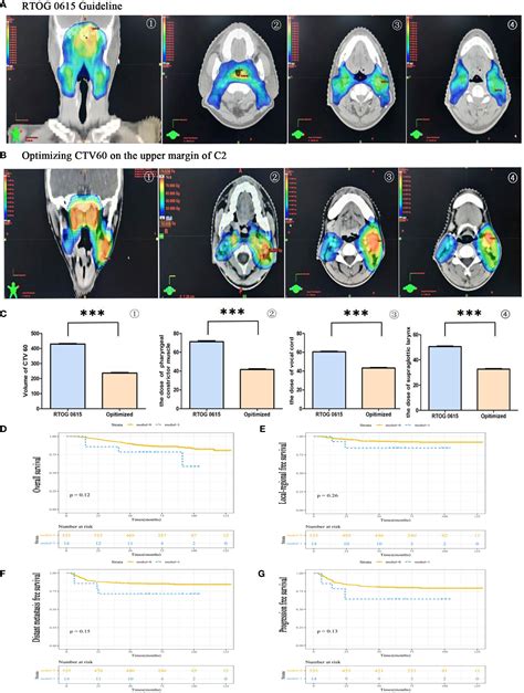 Frontiers Distribution Pattern Of Medial Group Retropharyngeal Lymph