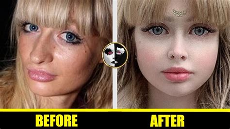 angelica kenova 👧 barbie doll plastic surgery before and after 👧 hot beautiful girls