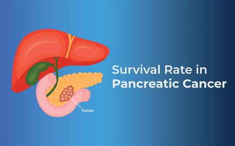 Survival Rate For Pancreatic Cancer Dr Nilesh Chordiya