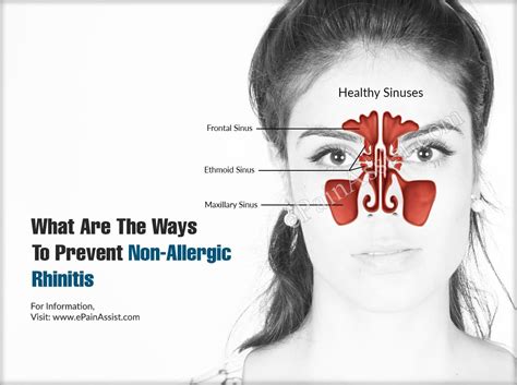 What Are The Ways To Prevent Non Allergic Rhinitis And Does It Reoccur