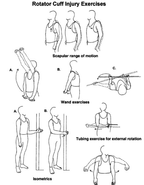Physical Therapy Exercises For Rotator Cuff Repair Phyqas
