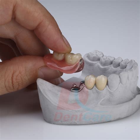 Replacement Of Teeth Manik Dental Clinic